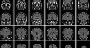 肺小細胞肺癌の生存率