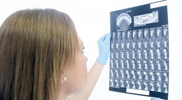 肺がんの放射線療法の適応