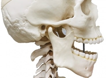 咀嚼筋腱腱膜過形成症 ブラキシズム