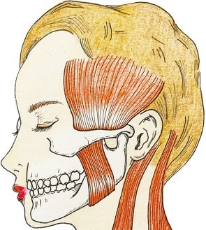 咀嚼筋腱腱膜過形成症 咀嚼筋とは