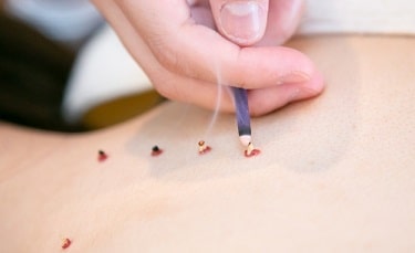 手の陽明大腸経