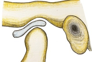 関節円板と半月板