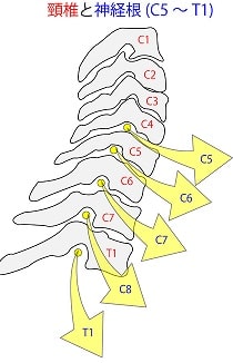 しびれ、麻痺の正体