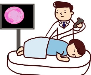 大腸癌の一般的な治療>