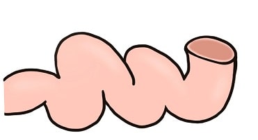 クレスト症候群