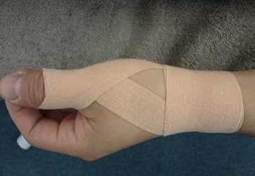 滑液包炎、腱鞘炎