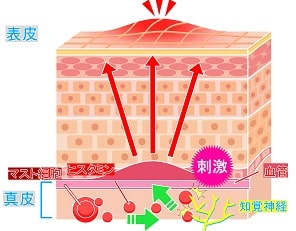 網膜剥離を起こすケース