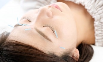 美容鍼とアンチエイジング