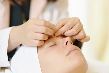 美容鍼とターンオーバー