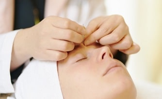 平衡感覚と顔鍼