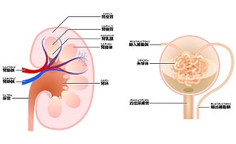 急性糸球体腎炎