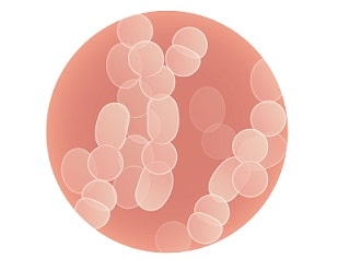 子宮内フローラ