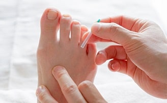 パーキンソン症候群の方の治療