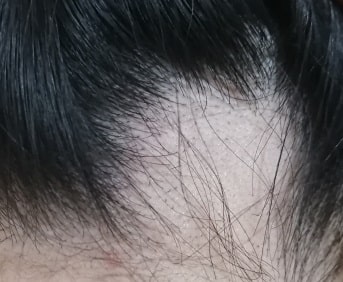 心身症 東洋医学