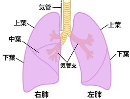 肺MAC症線維空洞型