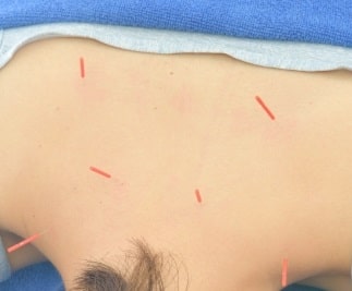 肺マック症の目標は？