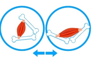 全身性関節弛緩症