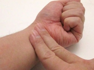 バセドウ病の症状