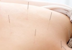 甲状腺機能低下