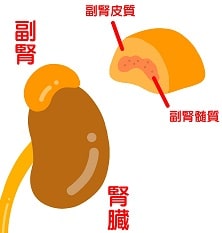 偽アルドステロン症