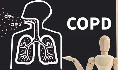 慢性閉塞性肺疾患（COPD）