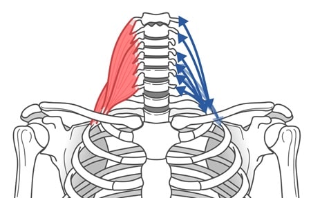 斜頸（しゃけい）