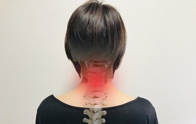 斜頸（しゃけい）1