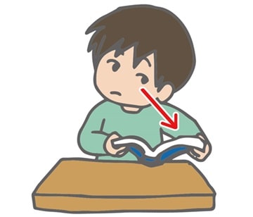 斜頸（しゃけい）2