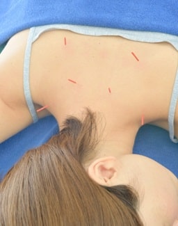 斜頸（しゃけい）4