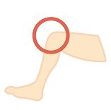 膝の痛み 軽度の圧迫